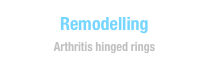 Remodelling
Arthritis hinged rings